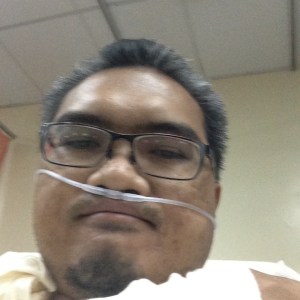 Dislocated Shoulder 2